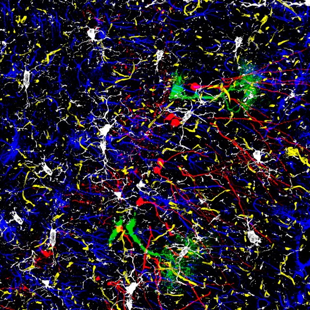 01_Nicolas-_Toni_Brain Crowd_03